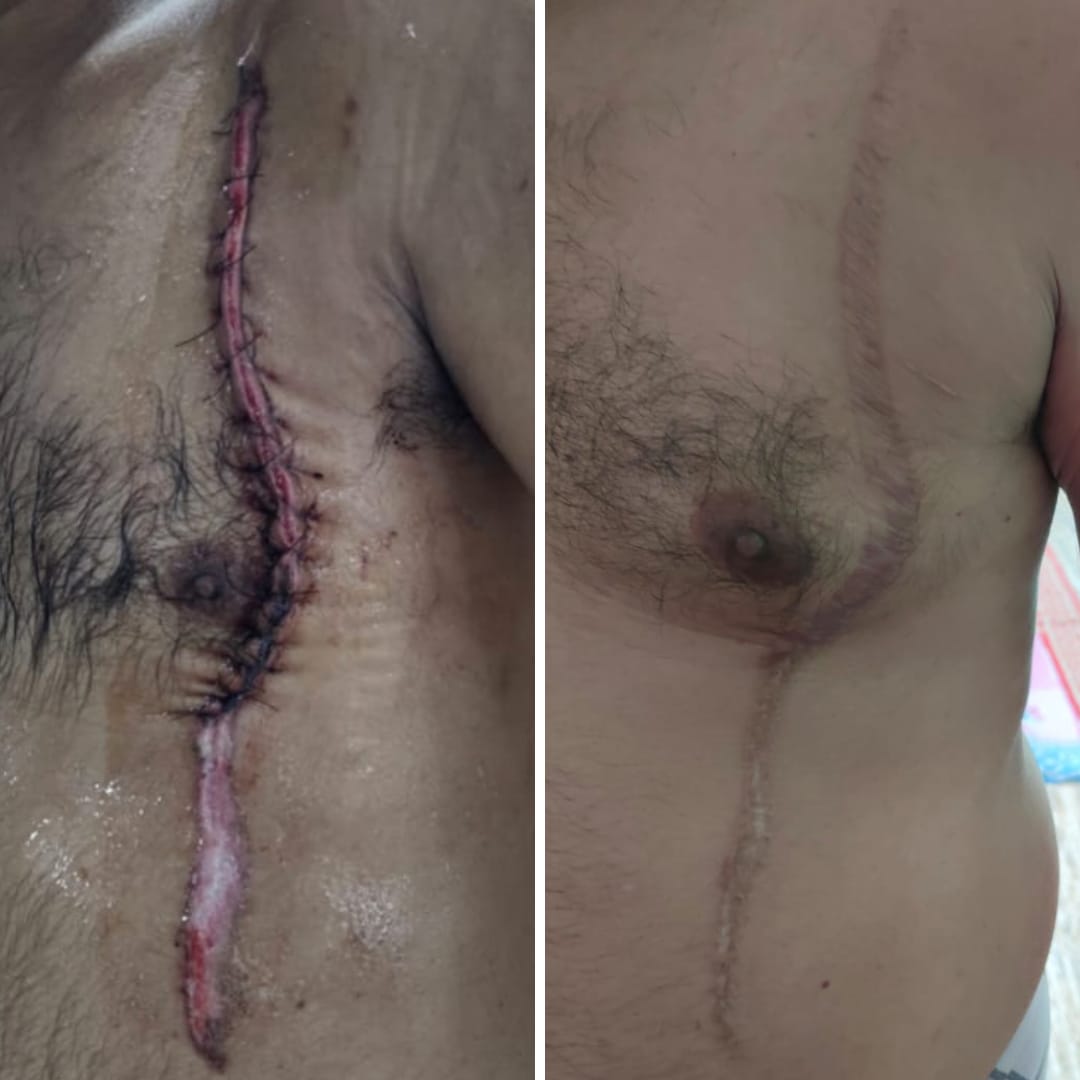 Post-trauma suture-removal and dressing documentation